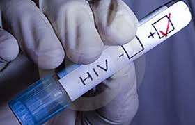 hiv