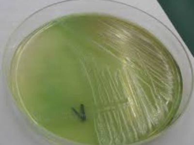 Pseudomonas aeruginosa (bacillus pyocyaneus) je u spoljnoj sredini široko rasprostranjena i izrazito otporna bakterija. To je Gram negativan, asporogen bacil. Brzo se kreće pomoću monopolarno raspoređenih flagela. Većina sojeva ima fimbrije. Striktni je aerob. P. aeruginosa ima brojne faktore virulencije, uključujući celularne komponente, toksine i enzime.