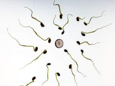 Spermogram je tzv. nativni pregled sperme. Ovim pregledom se dobijaju podaci o ukupnom broju spermatozoida, procentu progresivno pokretnih, ne-progresivno pokretnih, slabo pokretnih i nepokretnih spermatozoida.