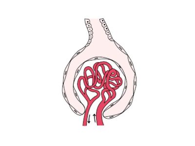 Glomerulonefritis (GN) je obostrano abakterijsko zapaljenje bubrega u kojem su zahvaćeni glomeruli , a propratno i druge strukture bubrega.