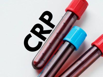 CRP je skraćenica koja označava C reaktivni protein. Reč je o proteinu koji se proizvodi u jetri. Njegova koncentracija u venskoj krvi se koristi kao značajan biohemiski parametar za mnoga stanja. Normalna koncentracija CRP - a se smatra do 10mg/l. Ne postoji značajna razlika između referentnih vrednosti za muškarce i žene, niti za životnu dob.